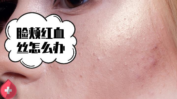 祛痘面膜原料有哪些 祛痘面膜怎么用